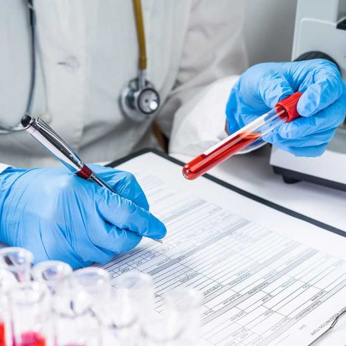 Blood-Tests Blood-Tests